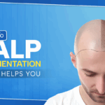 scalp micropigmentation guide